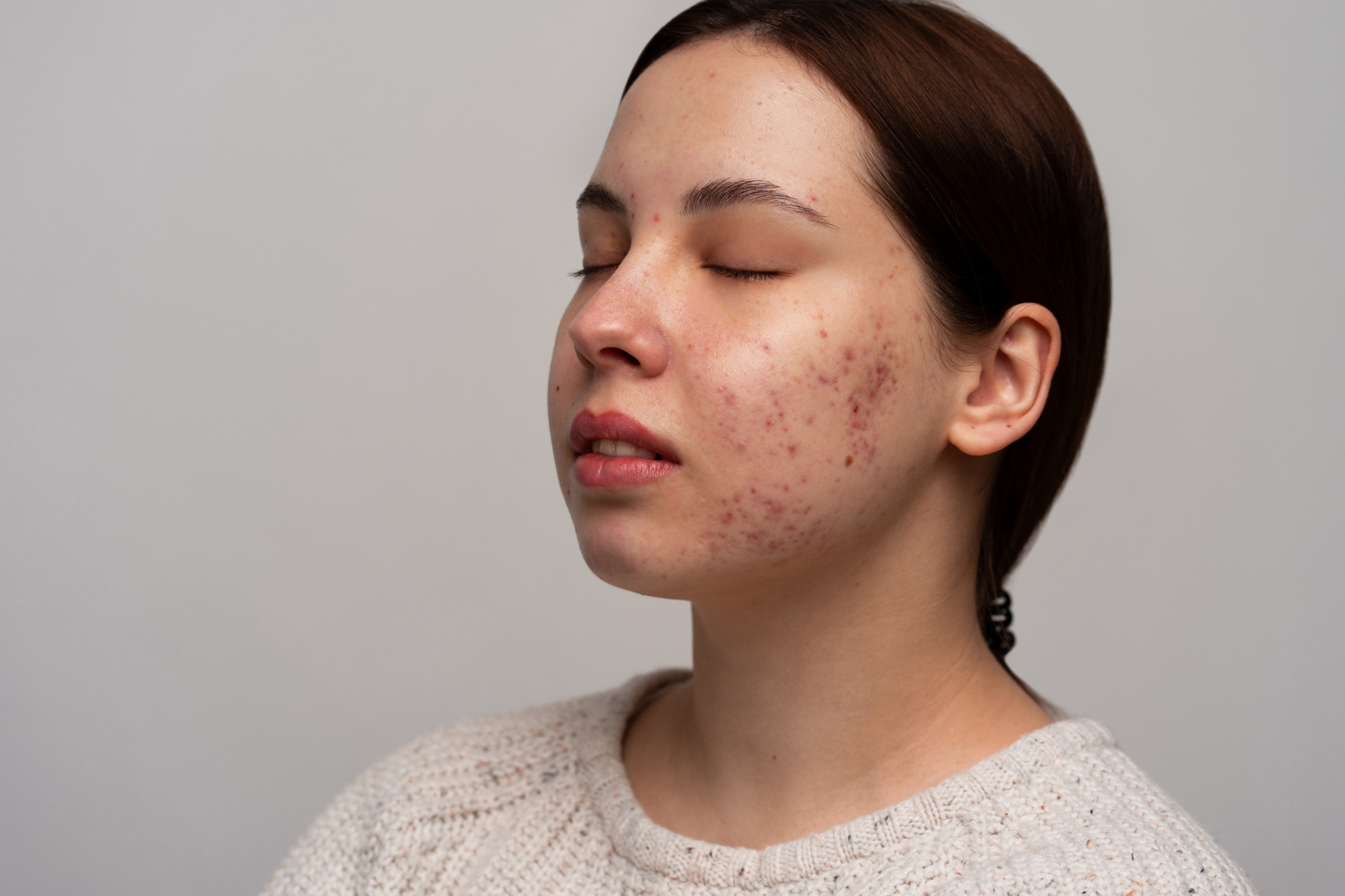 Infection and STD treatments